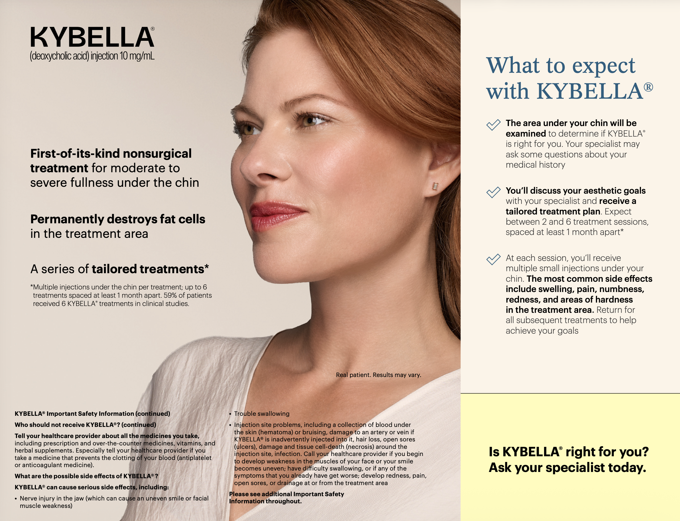 kybella before and after