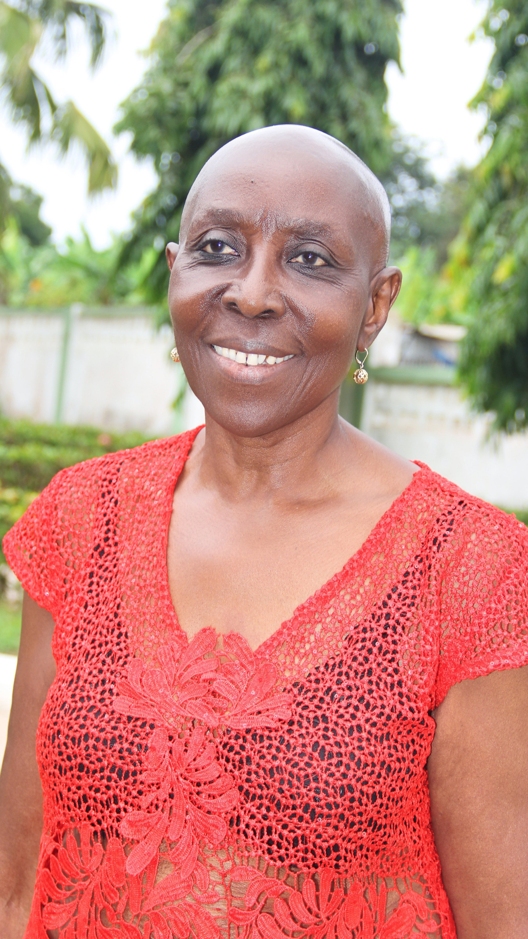 A smiling woman with a bald head wearing a red lace dress and earrings outdoors with trees in the background.