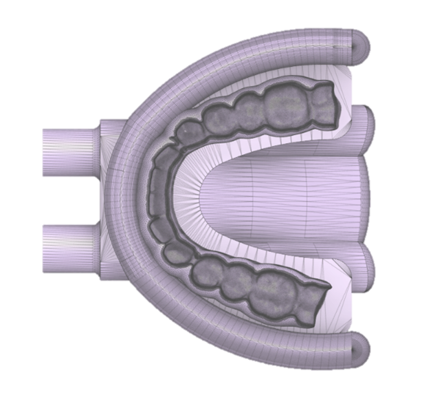 3D model of a human mouth with teeth and gums, featuring a green section at the bottom right.