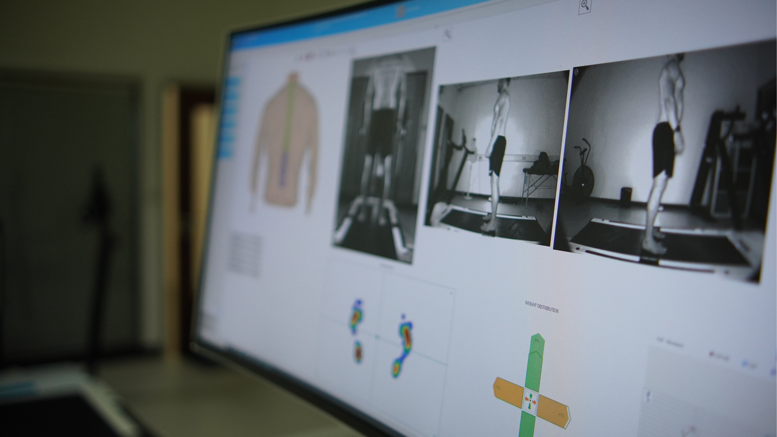 Clinical Gait Analysis (Diers 4D)