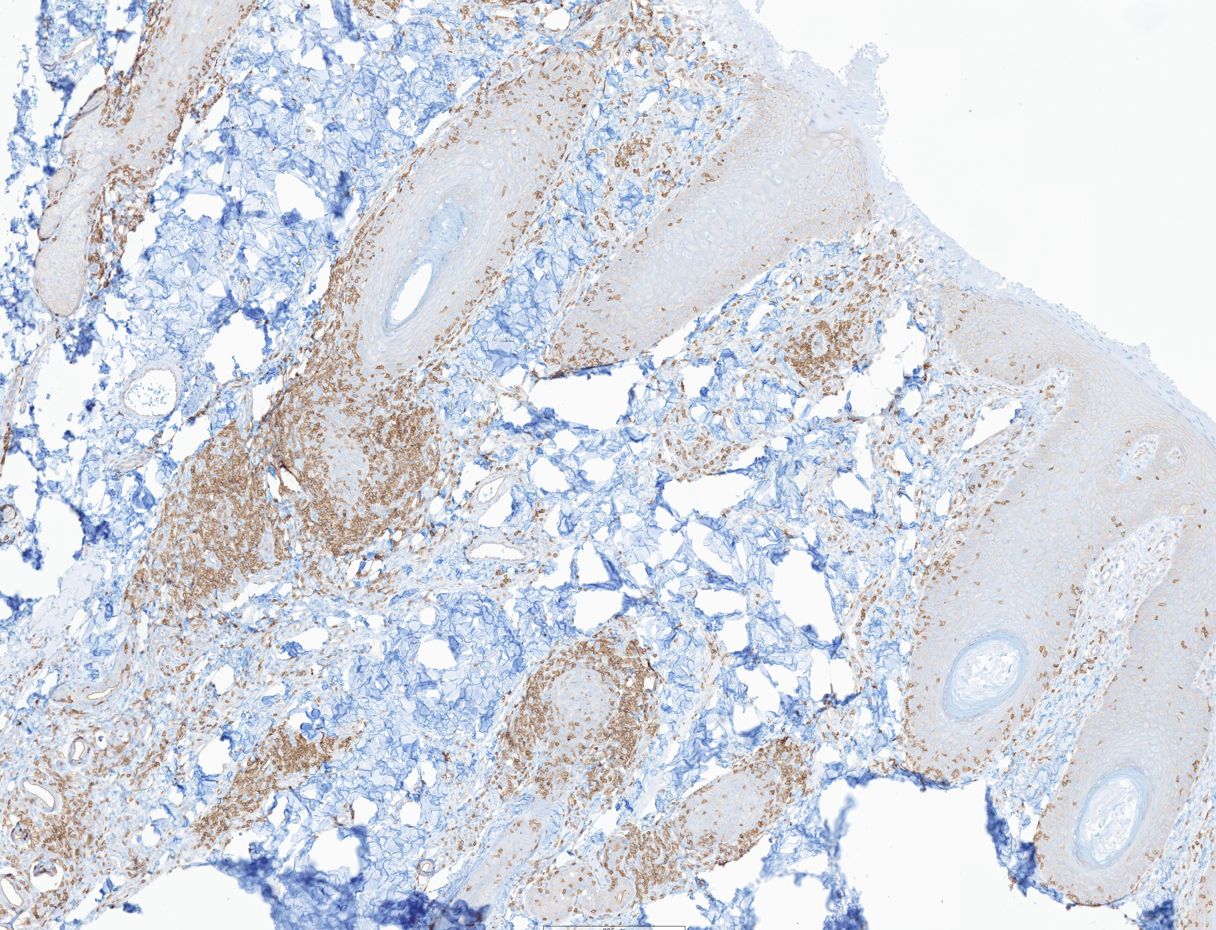Special Stains vs. Immunohistochemistry: What They Are and When Your Pathologist Uses Each
