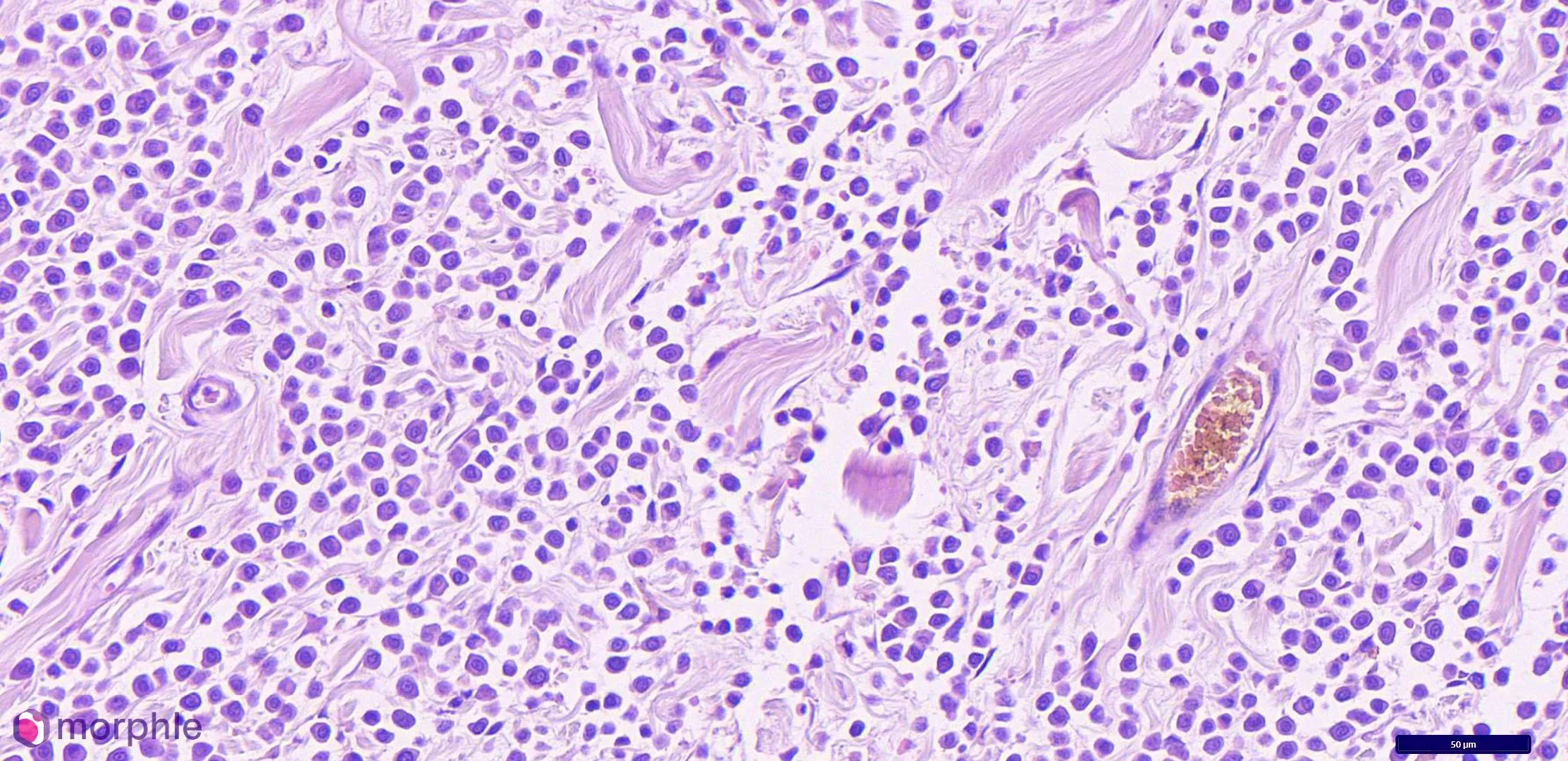 Canine Mast Cell Tumor Grading: Understanding the Two Systems and What Your Report Is Actually Telling You