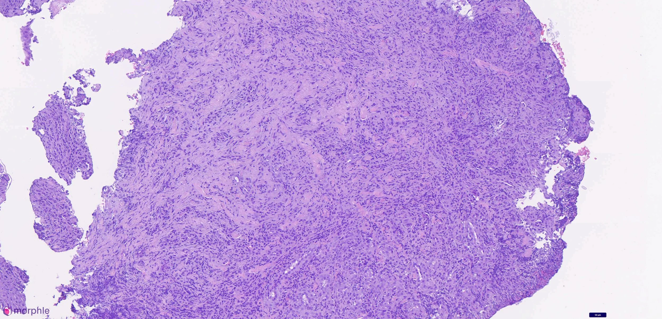 A 2 cm Buccal Mucosa Mass, Tooth 309, and What Pyogenic Granuloma Actually Is
