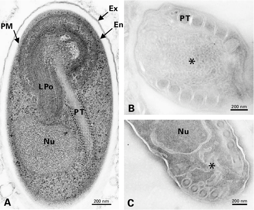EM image of E. cuniculi