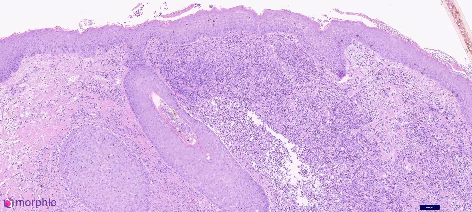 Dermatopathology histology image