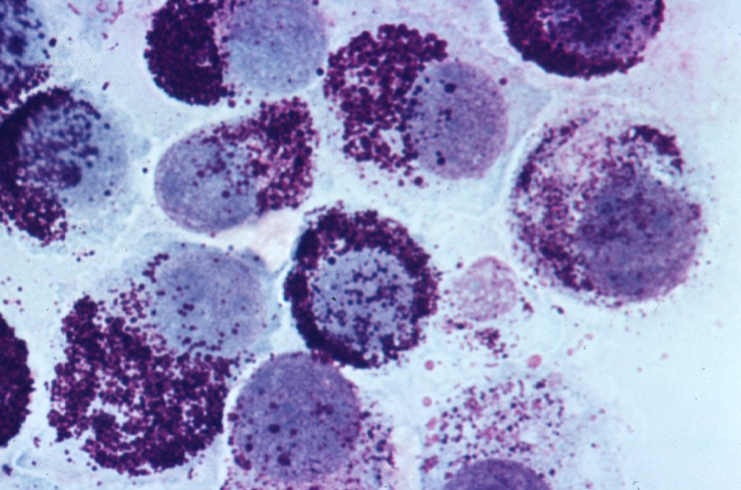 mast cell tumor cytology