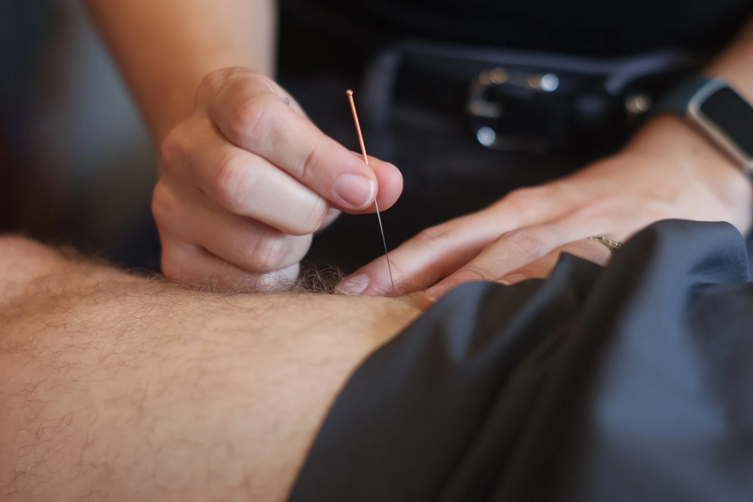 Intramuscular Stimulation