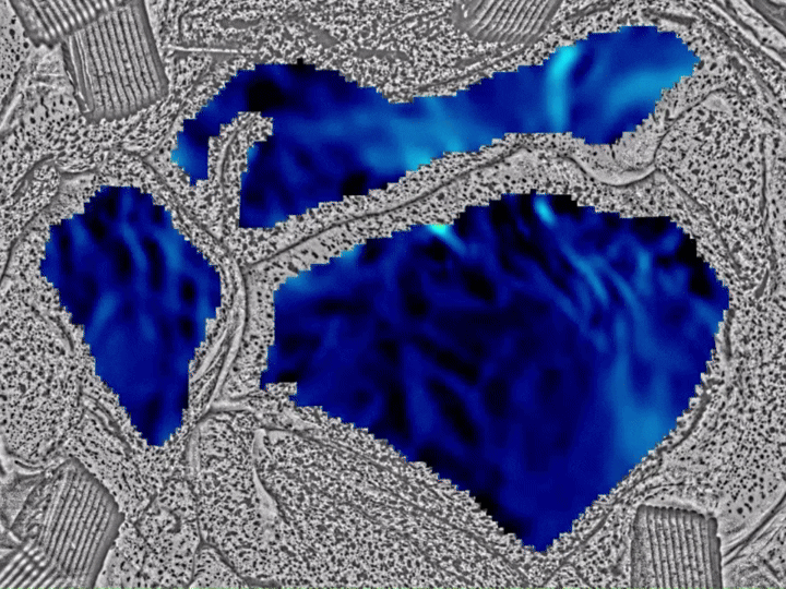 3D DIC of the tricuspid valve.