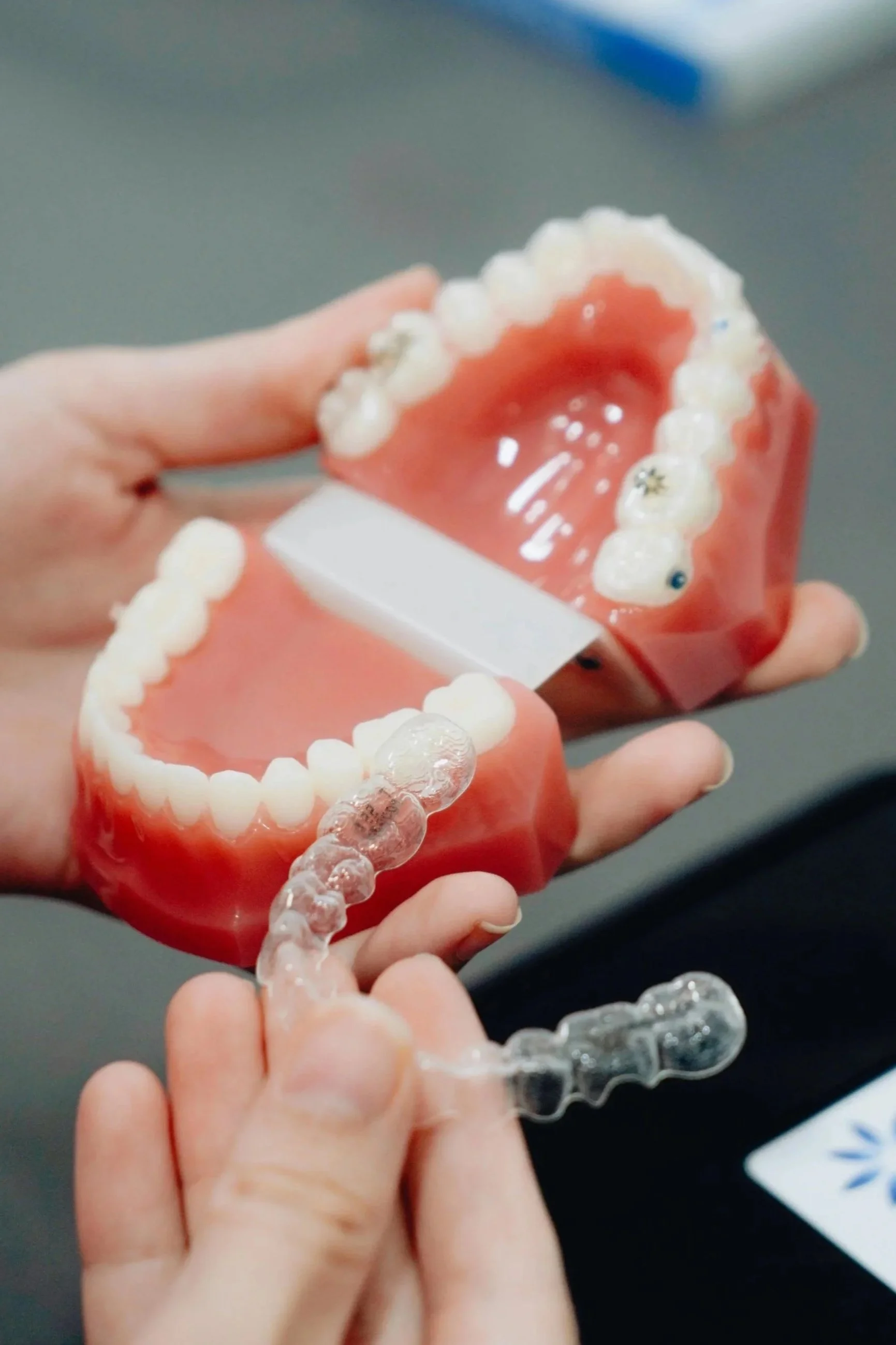 Clear Aligners