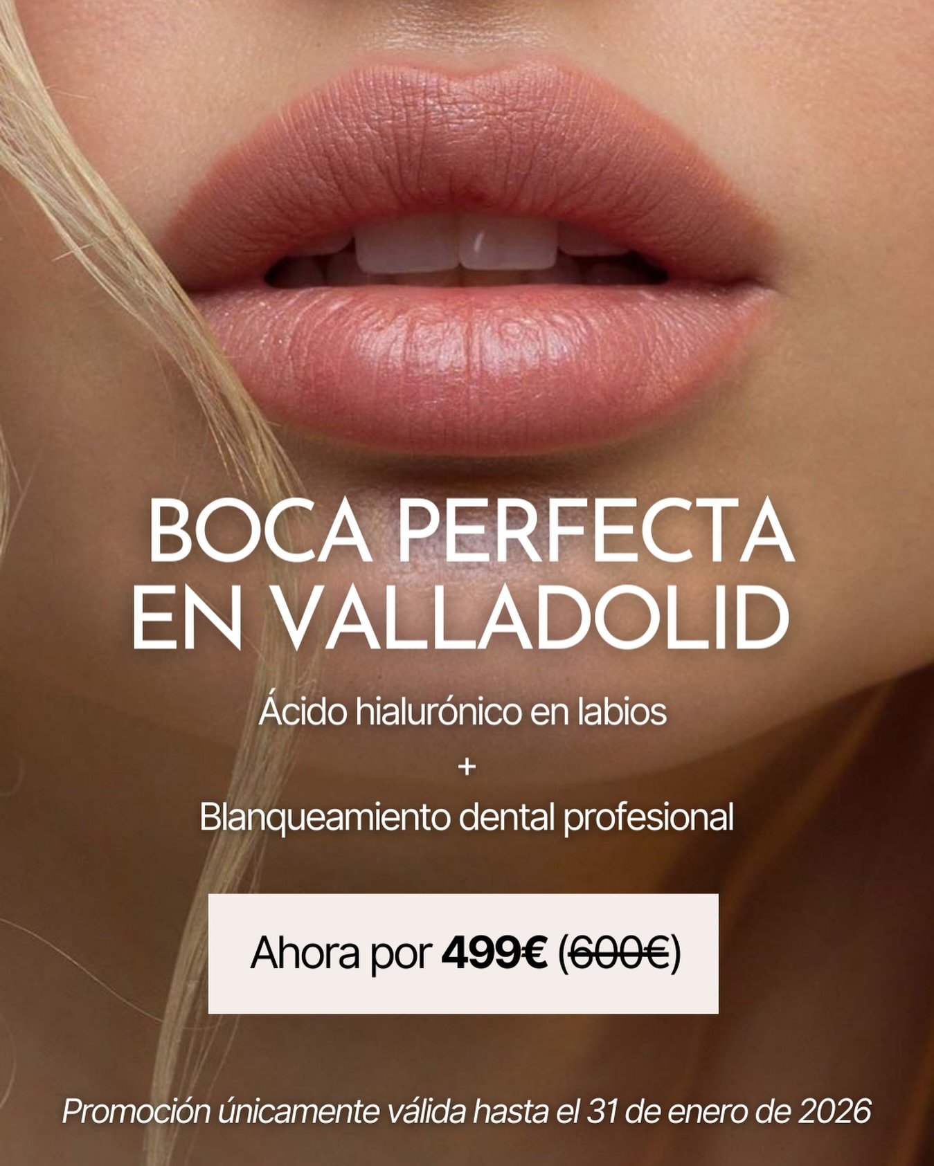 &iquest;Labios m&aacute;s definidos y una sonrisa m&aacute;s luminosa?
Ahora puedes conseguirlo en Cl&iacute;nica Apolonia (Valladolid) con una promoci&oacute;n exclusiva que combina est&eacute;tica facial + est&eacute;tica dental en una &uacute;nica