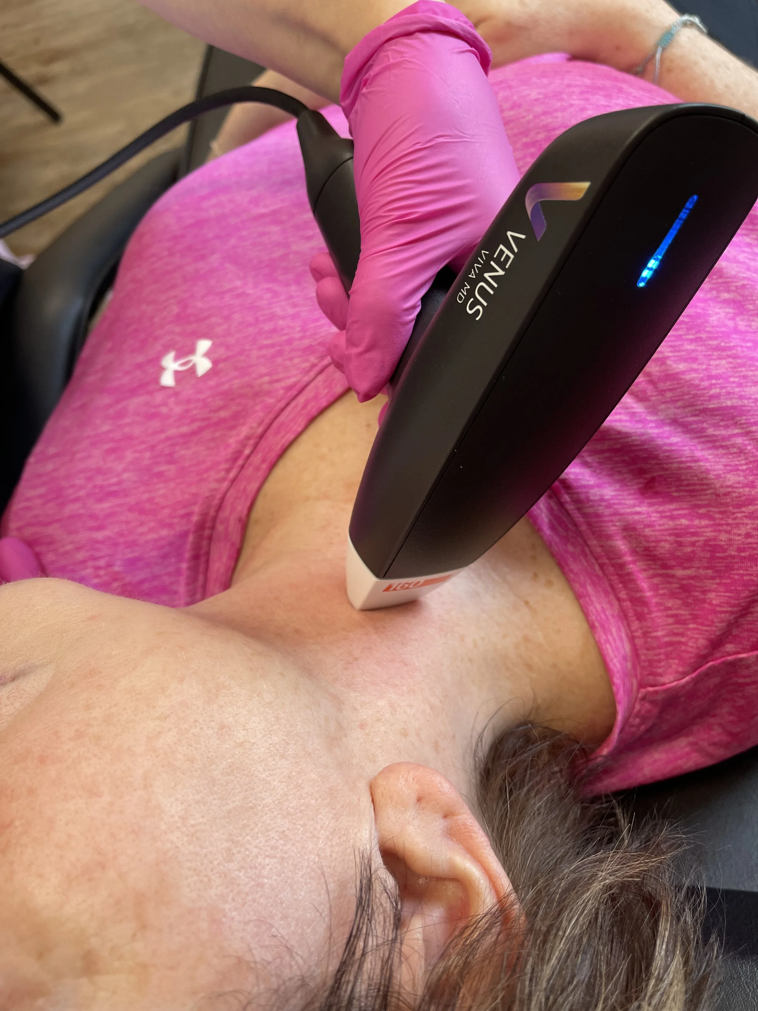 Medspa in Derby, VT, 05829 | Skin resurfacing Near Me
