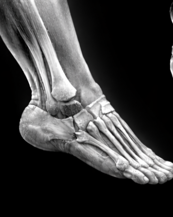 X-ray image of a human foot showing bones and joints