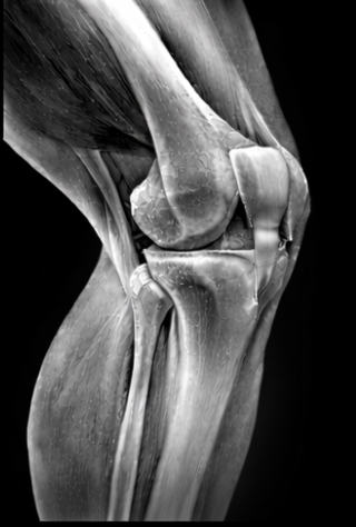 Black and white X-ray of a human knee joint showing bones and cartilage.