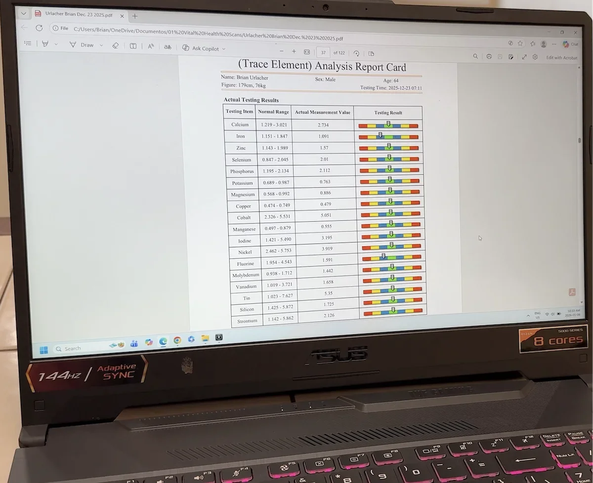 Laptop showing the results of a trace element scan for vital body health.