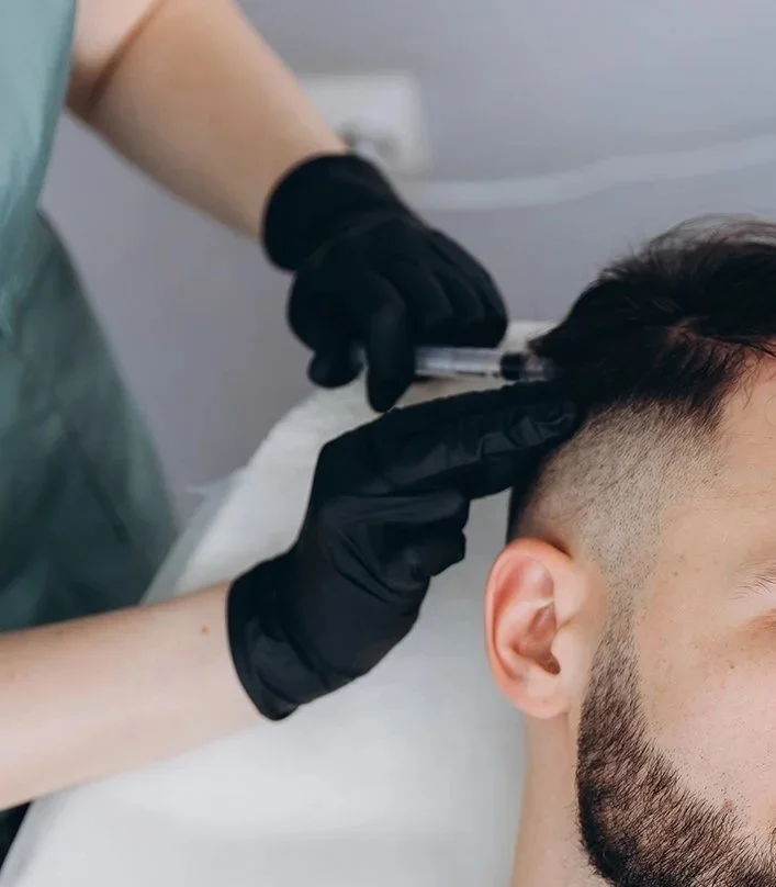 Close-up of a person receiving a scalp tattoo or microblading procedure on their head, with a medical professional wearing black gloves administering the treatment.
