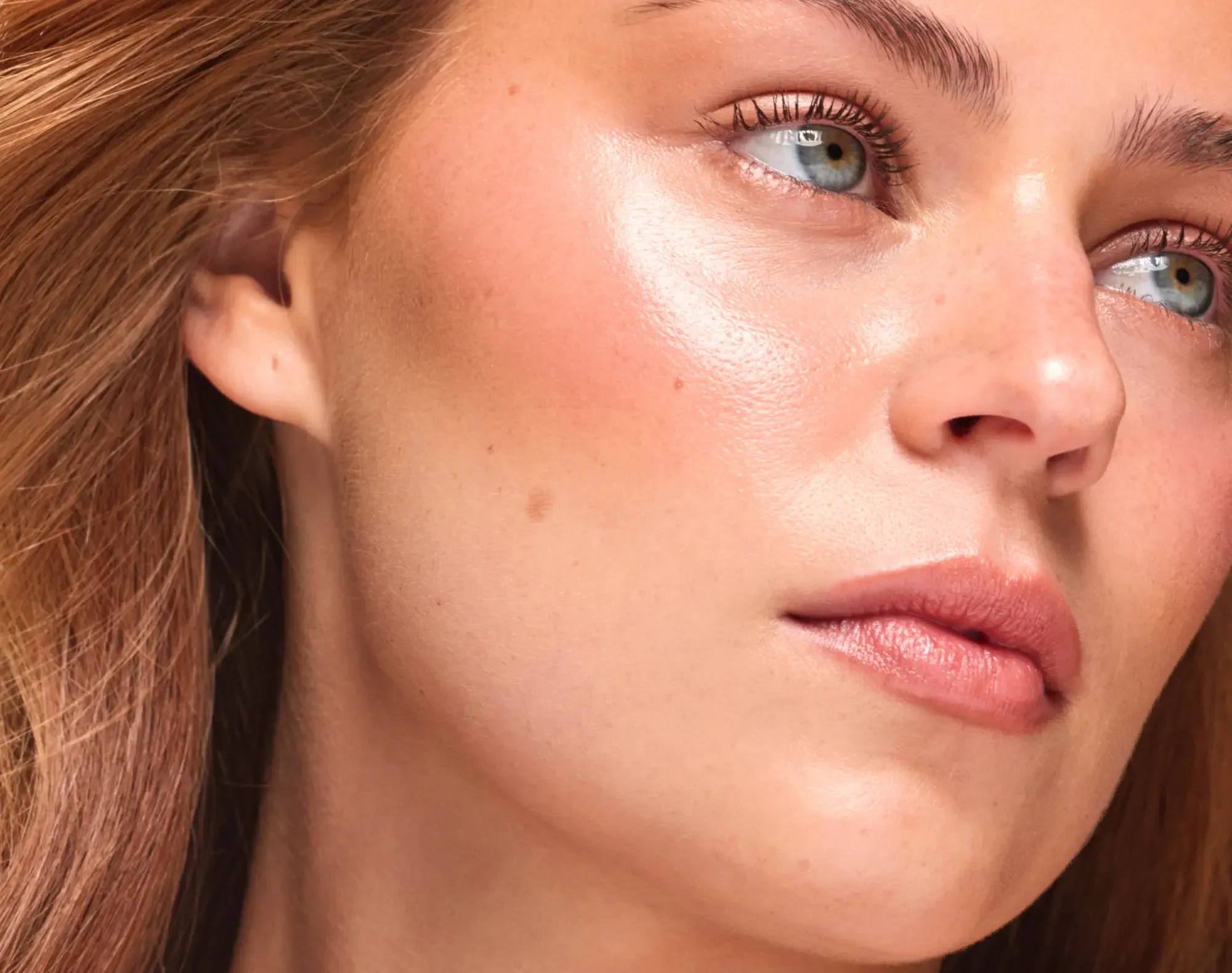 532nm laser pigment correction