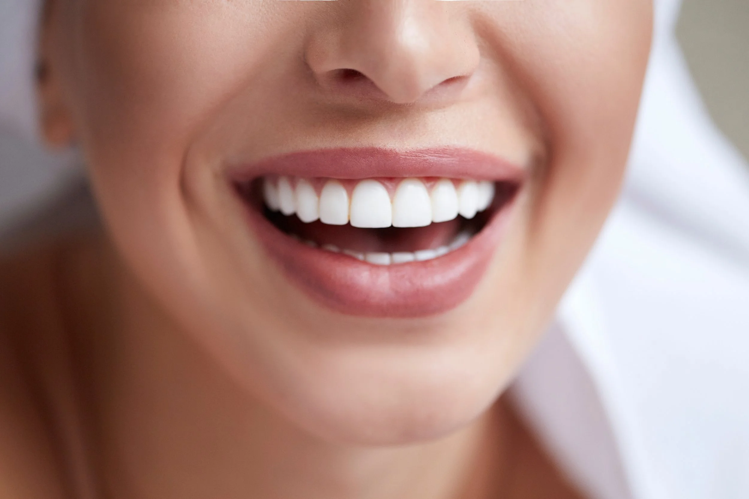 Close-up of a woman smiling with bright, even teeth showing the cosmetic results of dental veneers