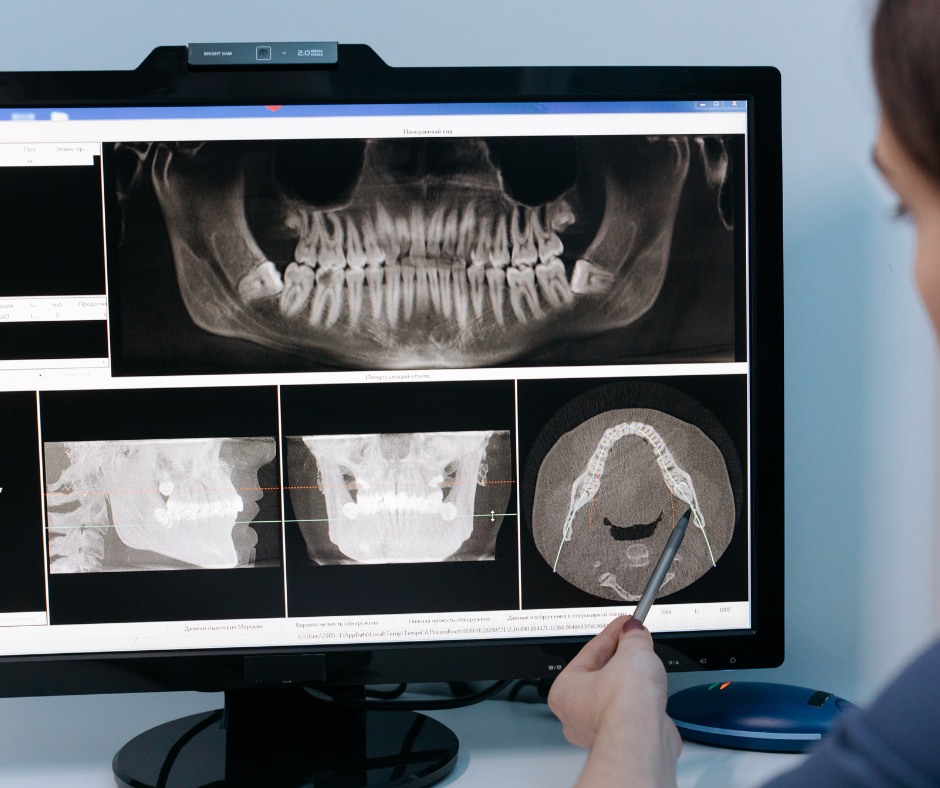 Dentist reviewing dental X-ray images on a computer monitor and pointing at a scan