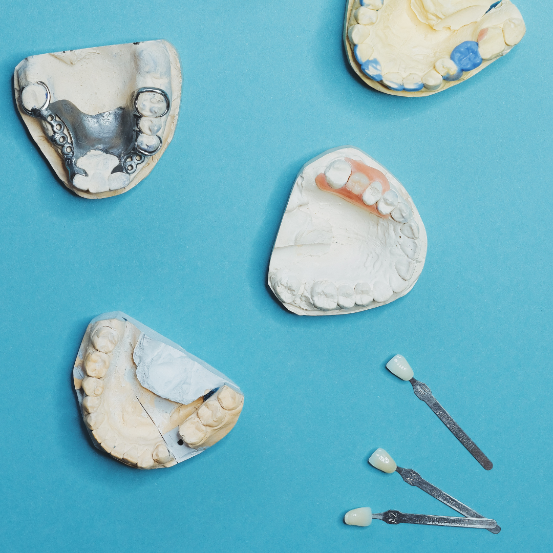 Dental impressions and tooth shade samples displayed on a blue background for missing teeth replacement options