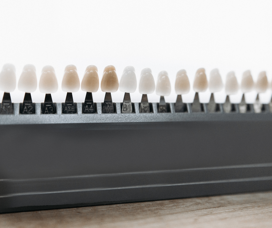 Shade guide showing different porcelain veneer colours on a dental model