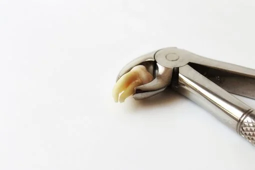 Dental extraction tool holding a tooth, demonstrating the removal process during a tooth extraction
