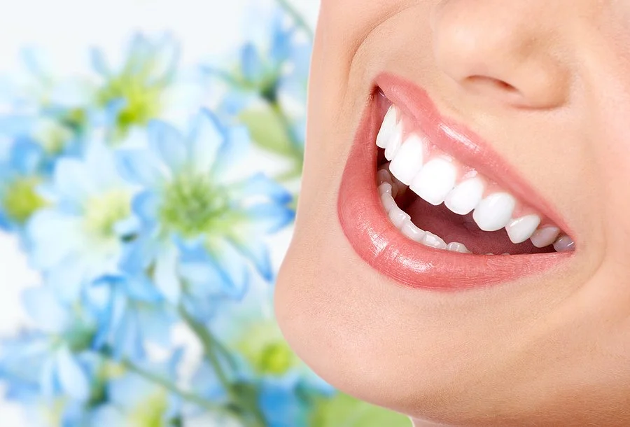 Close-up of a bright, flawless smile to demonstrate the cosmetic improvements achievable with dental veneers