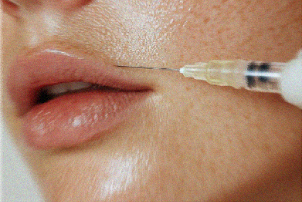 Medspa in Austin, TX, 78701 | Dermal Fillers Near Me.png