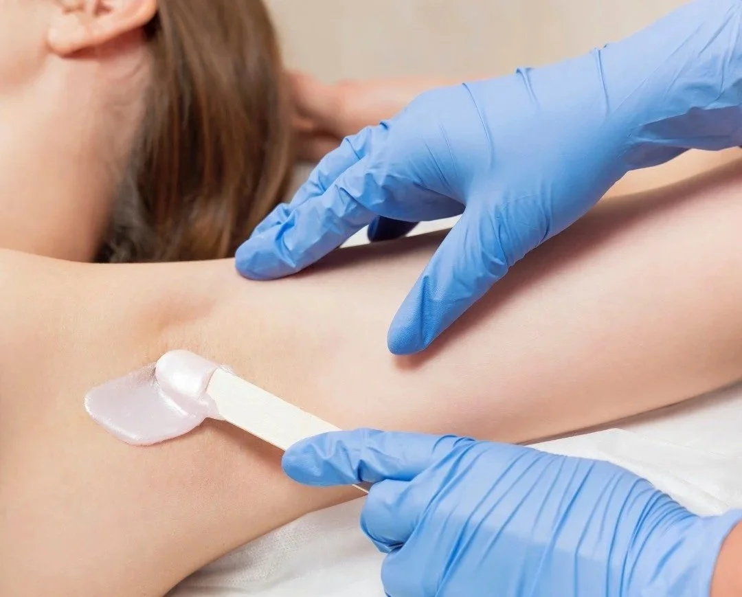 A person with light skin is receiving a waxing treatment on their armpit by a technician wearing blue gloves, using a spatula with wax.