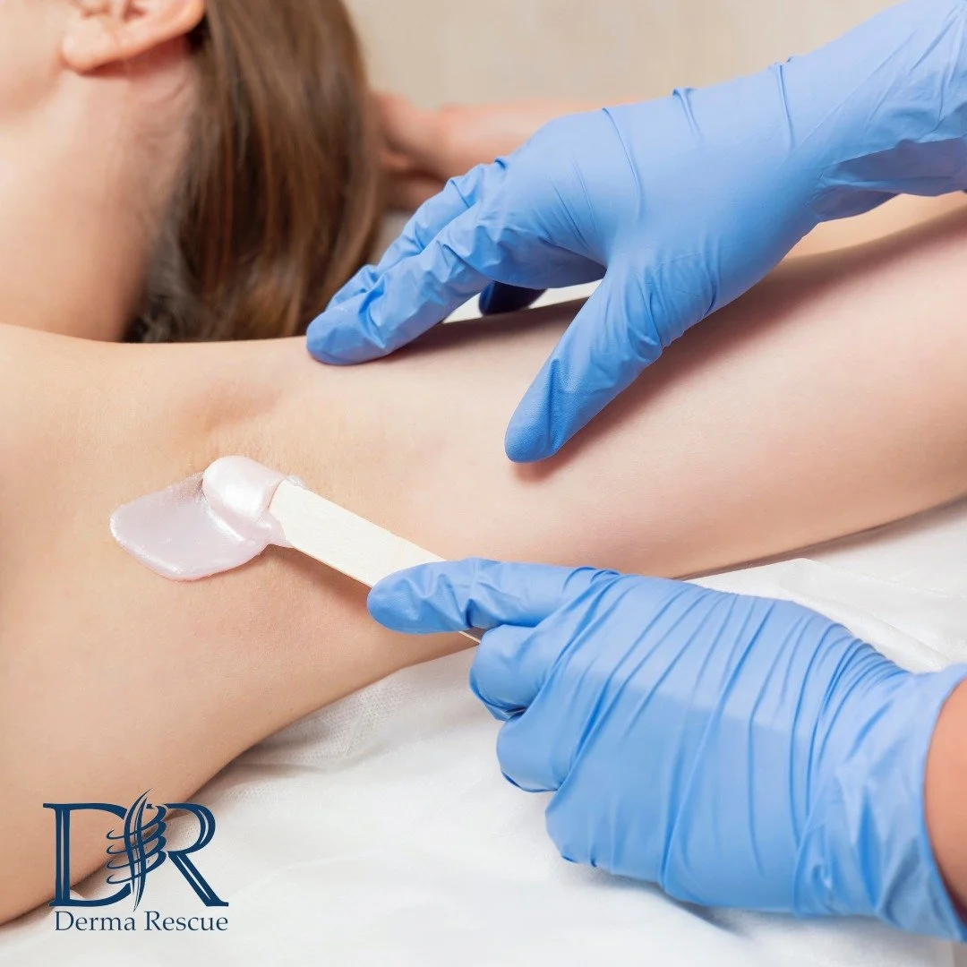 A person receiving a skincare or medical treatment on their upper arm with a spatula applying a white cream, while a healthcare professional in blue gloves applies a clear gel or ointment. The scene is clinical with the logo 'Derma Rescue' in the bottom left corner.