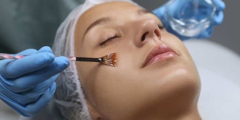 Close-up of a woman receiving a facial treatment, with a technician applying a facial mask or peel using a brush on her cheek. The woman has her eyes closed and appears relaxed.