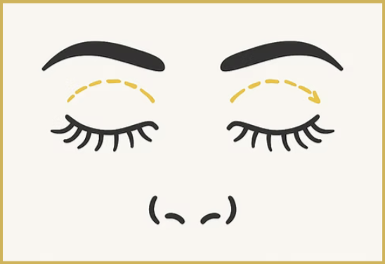 Illustration of a closed eye with eyebrow, eyelash lines and dotted lines across the lids, indicating where it will be improved/lifted.