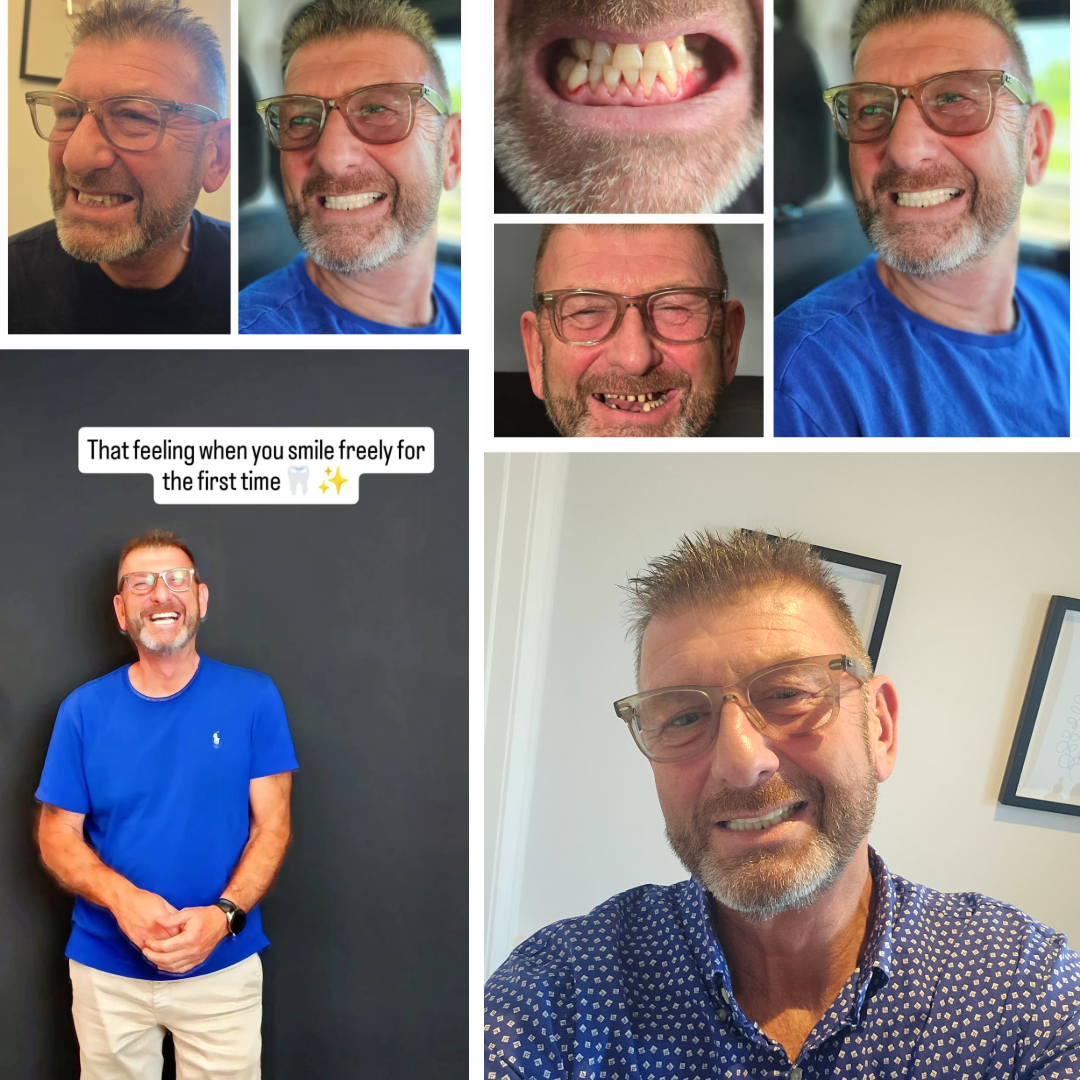 Multiple photos of a man with glasses, smiling, showing teeth, some with missing or crooked teeth, then clean straight ones. One photo includes a caption saying, 'That feeling when you smile freely for the first time.' Ars Salutaris Clinic in Croatia