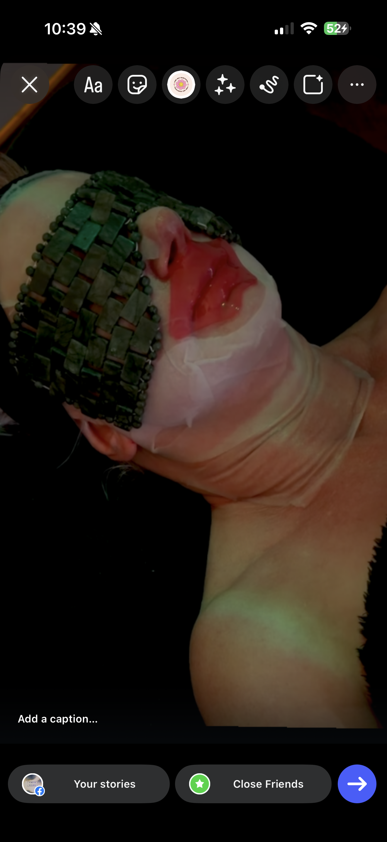 Close-up of a person's head with a greenish bandage around the forehead, which is covered with a woven metallic headband. The person's face appears to be injured, with redness and swelling on the lips and cheek. The person is wearing gloves and appears to be lying down or reclining.