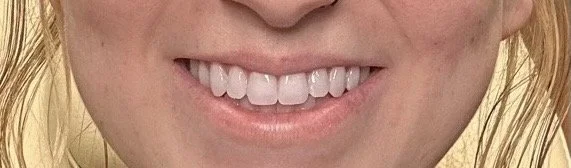 RenderedImage 5.JPEG