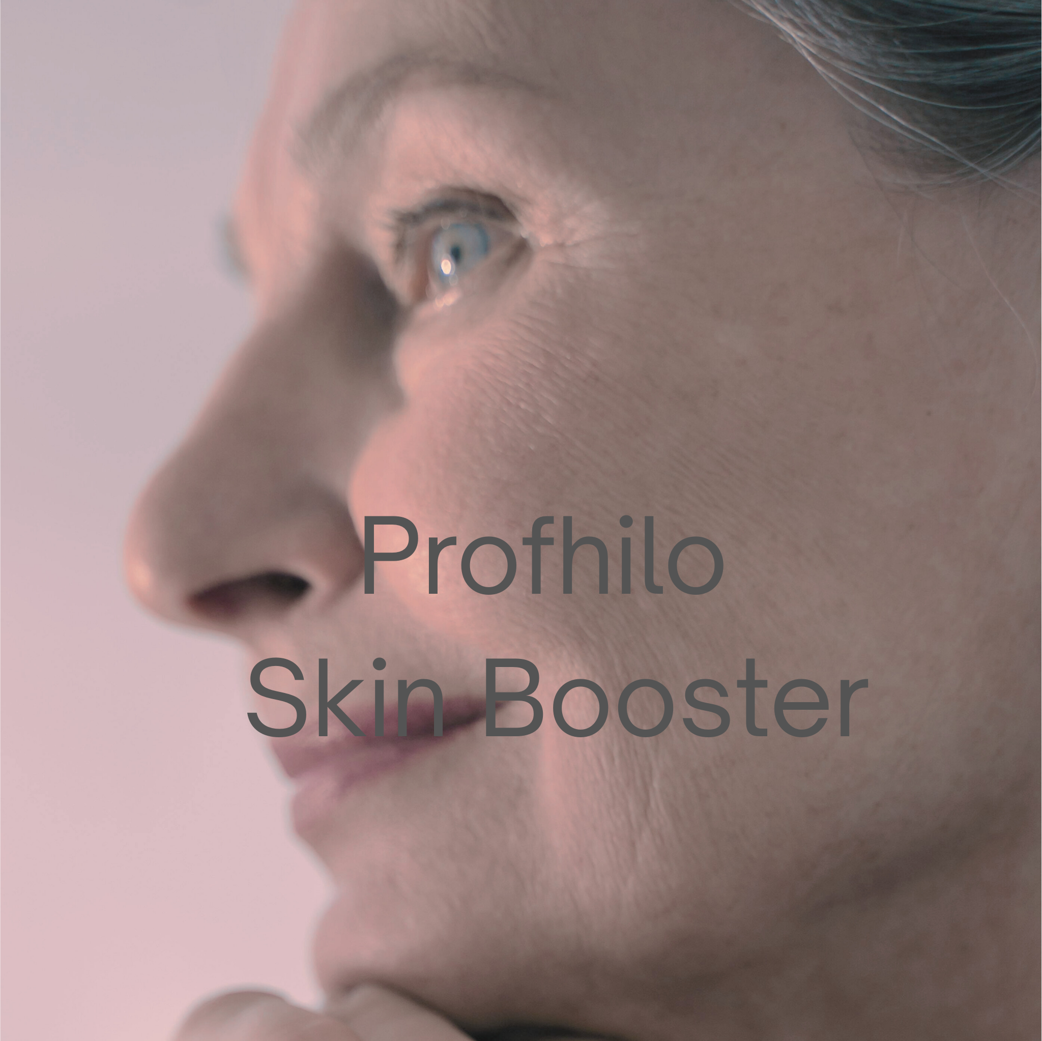 Profhilo Skin Boosters