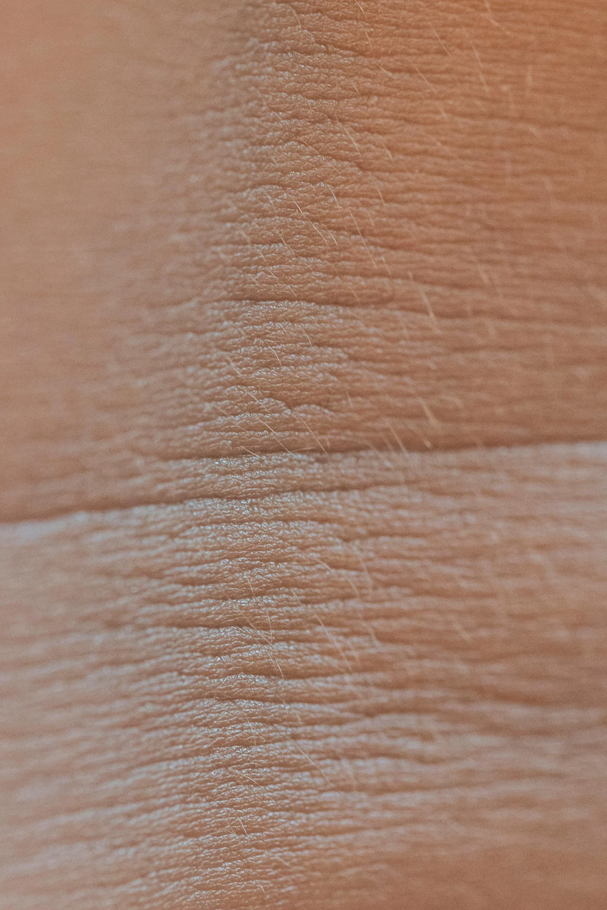 Close-up of human skin showing detailed texture, wrinkles, and fine hair.