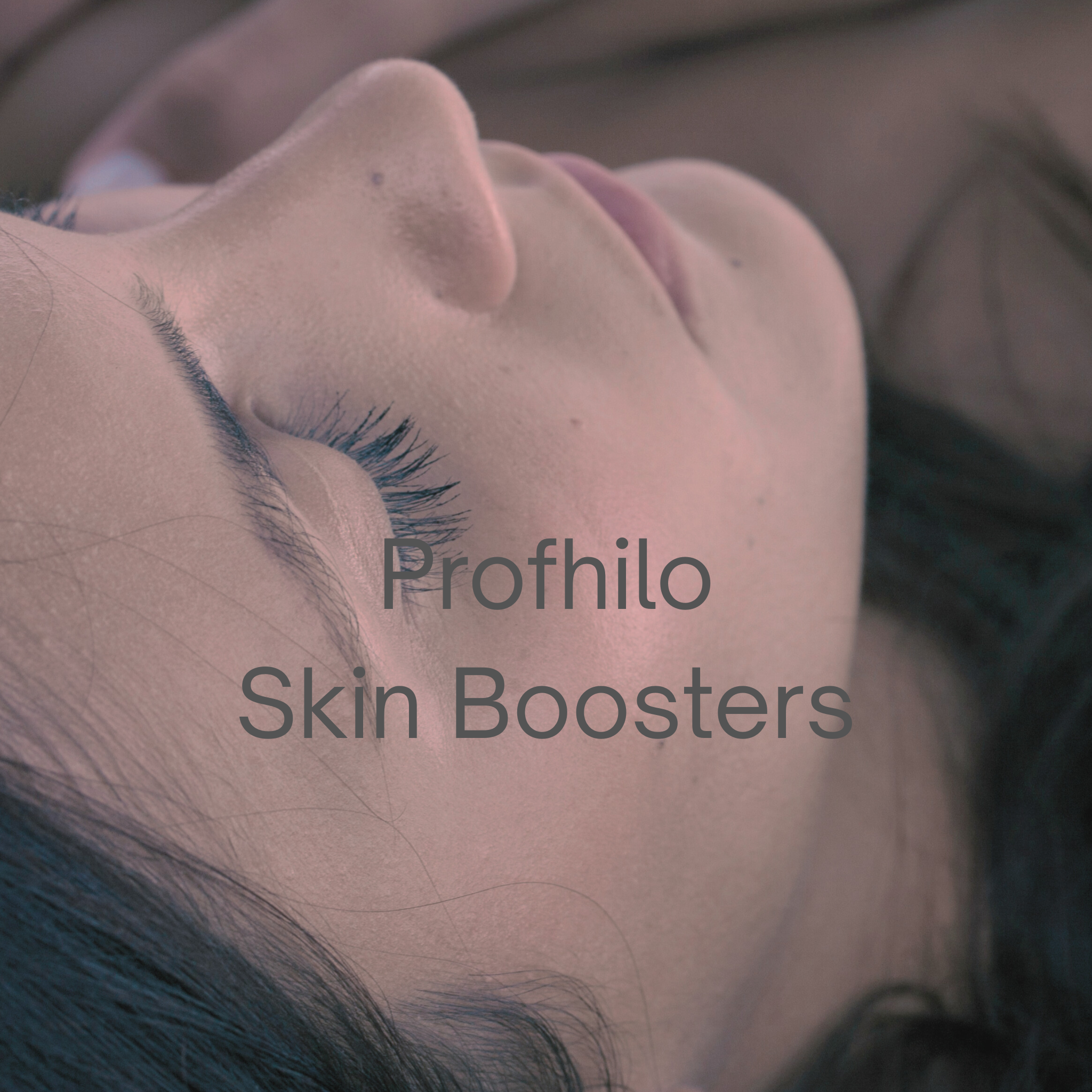Profhilo Skin Boosters