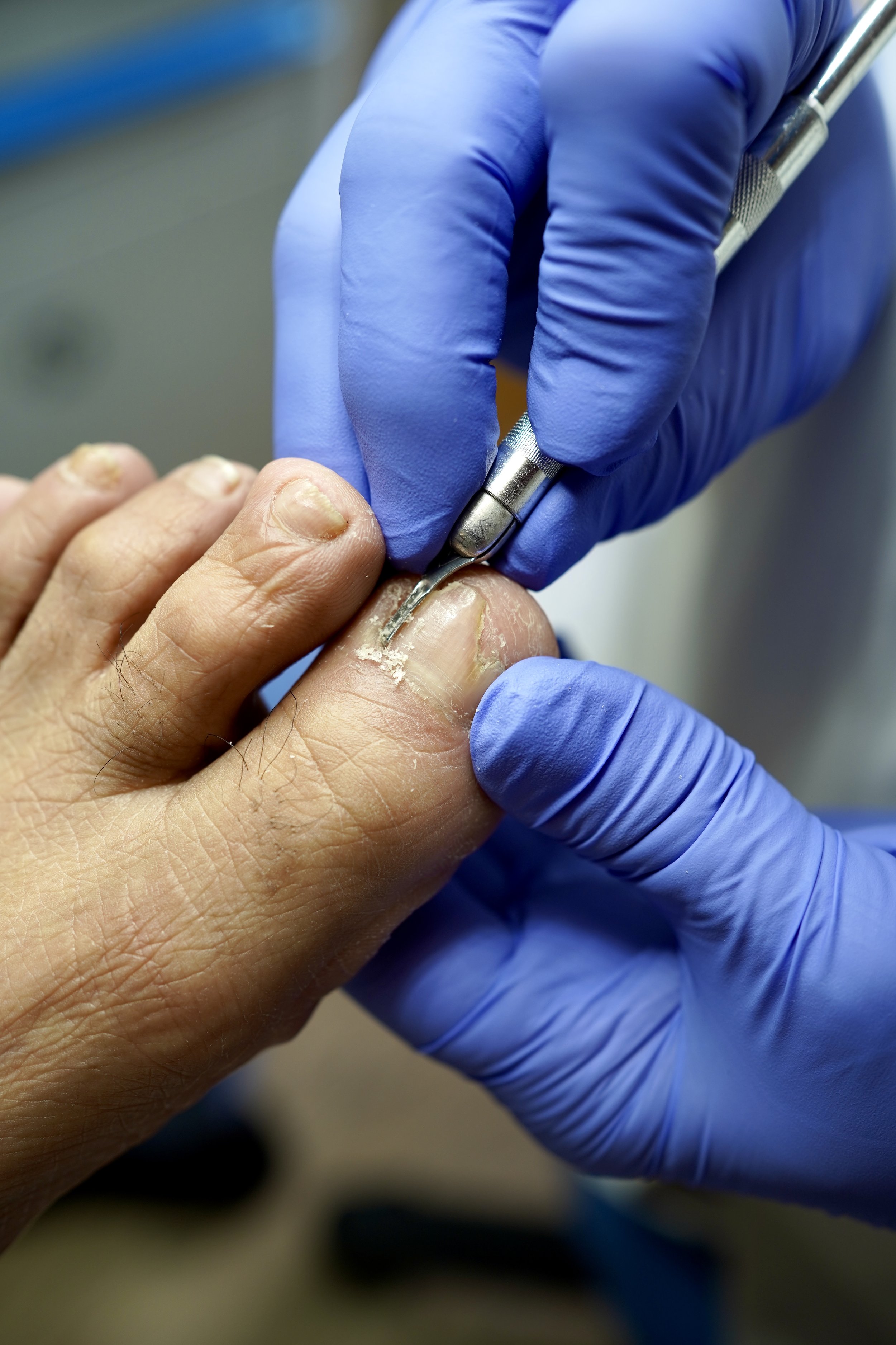 MediPedi NYC - Medical Pedicure - Aesthetic & Therapeutic Foot Care