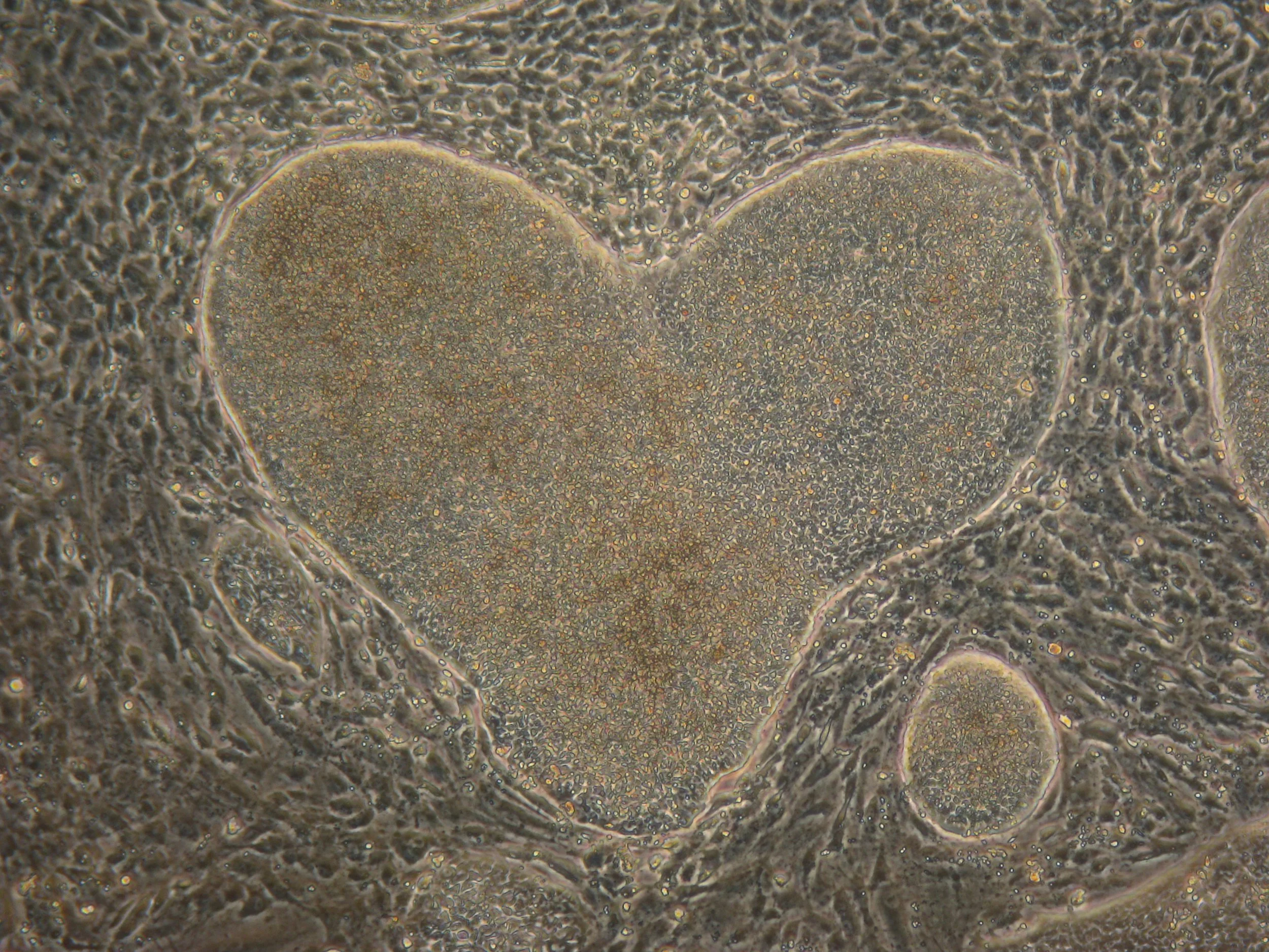 Microscopic view of a heart-shaped structure with surrounding cellular material.