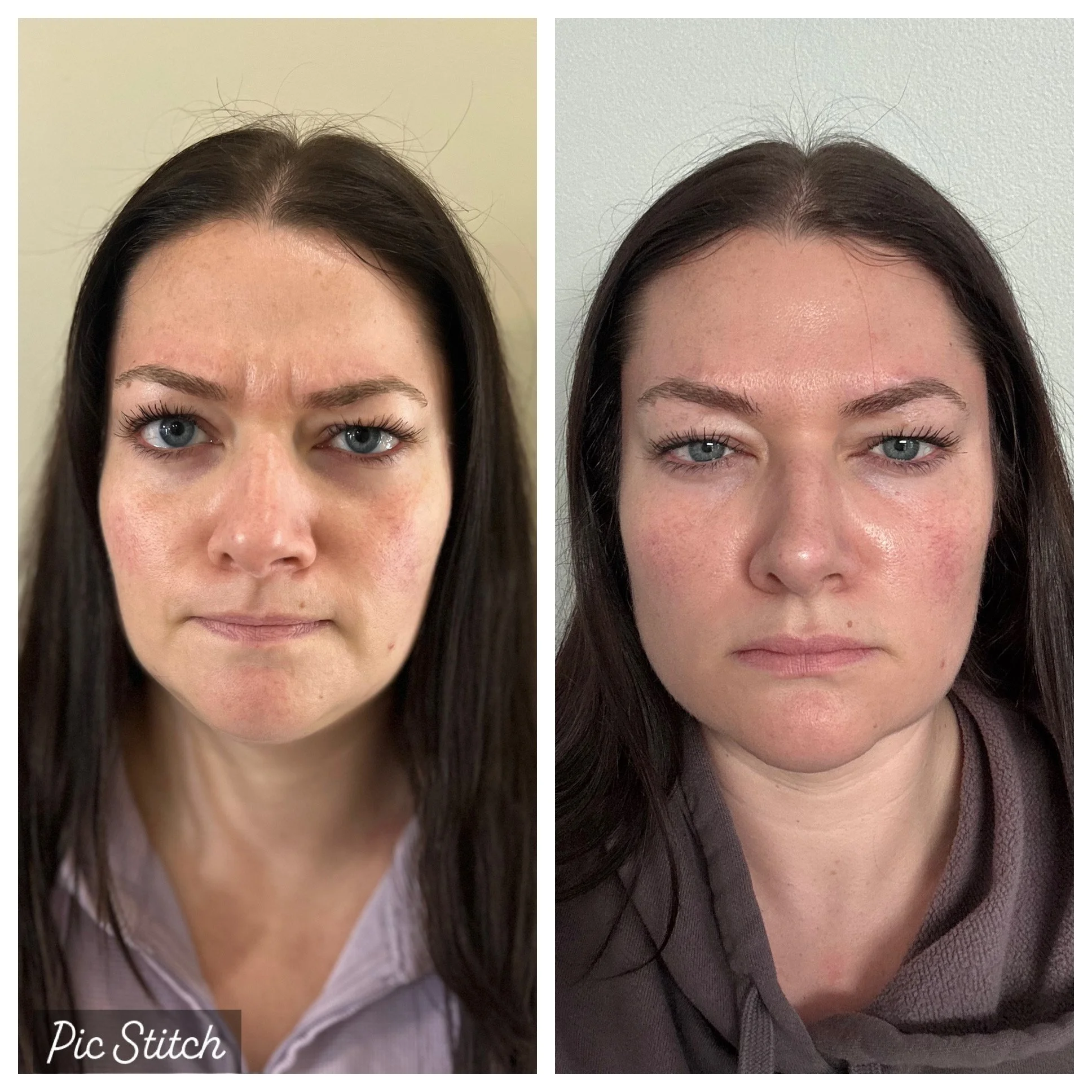 Before and after side-by-side comparison of a woman with clear skin and makeup, showing a reduction in redness and skin imperfections in the after photo.