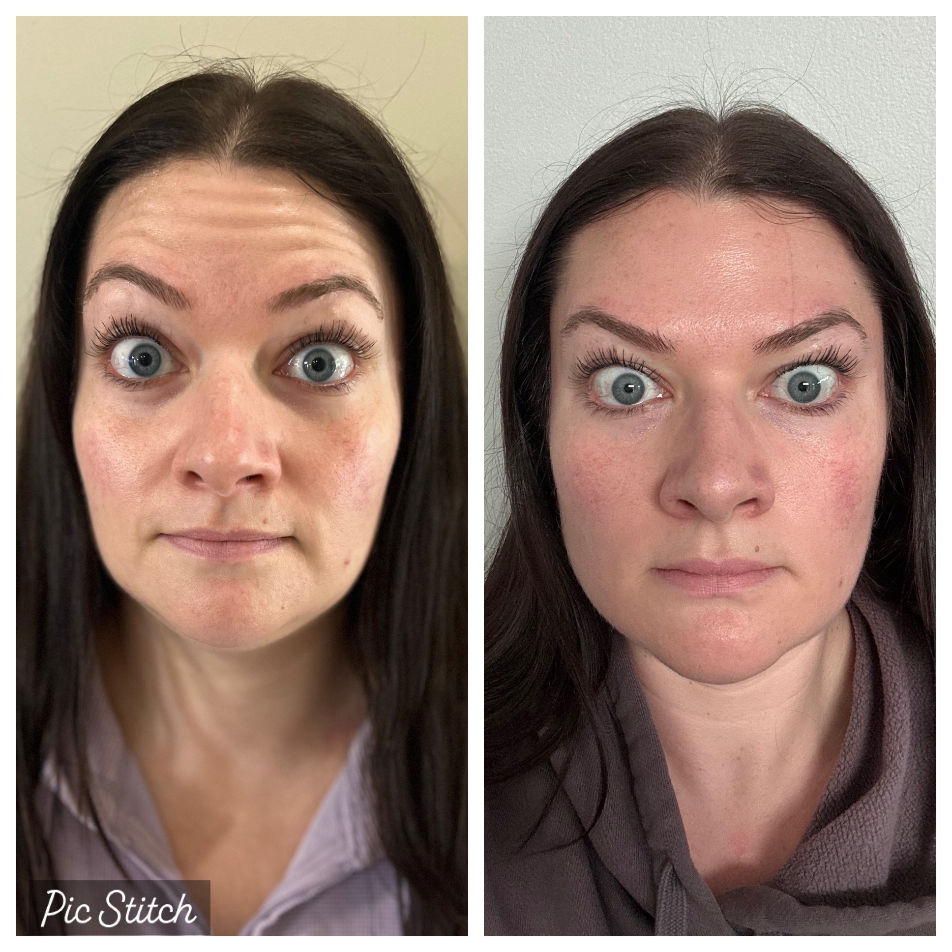 Comparison of a woman before and after using Pic Stitch app, showing skin improvement and makeup removal.
