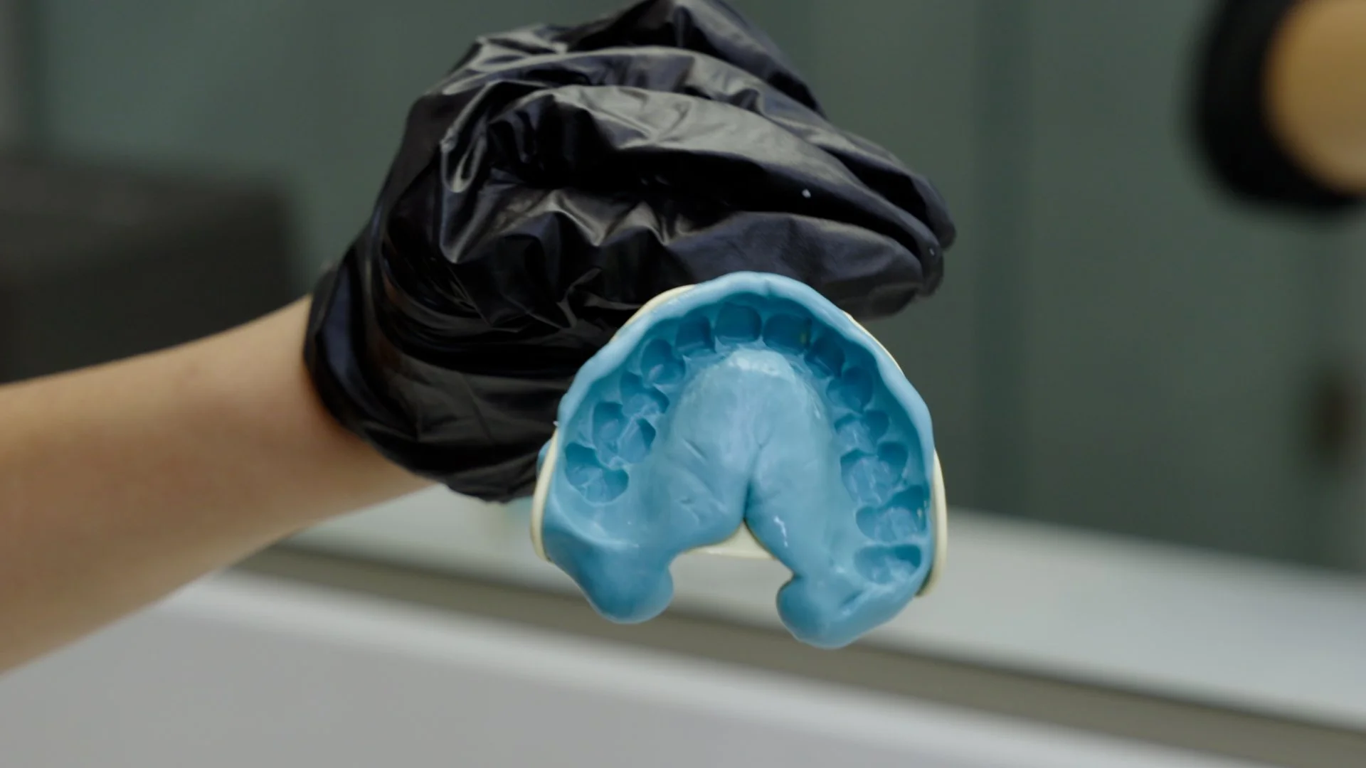 Person wearing a black glove holding a dental impression mold of a blue upper mouth with teeth.