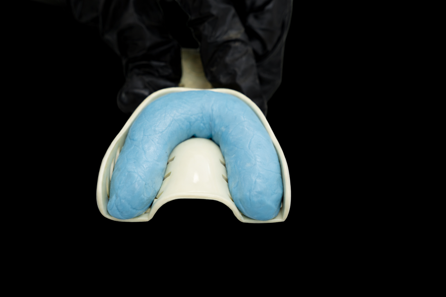 Dental impression mold with blue and white materials being used by a person wearing black gloves
