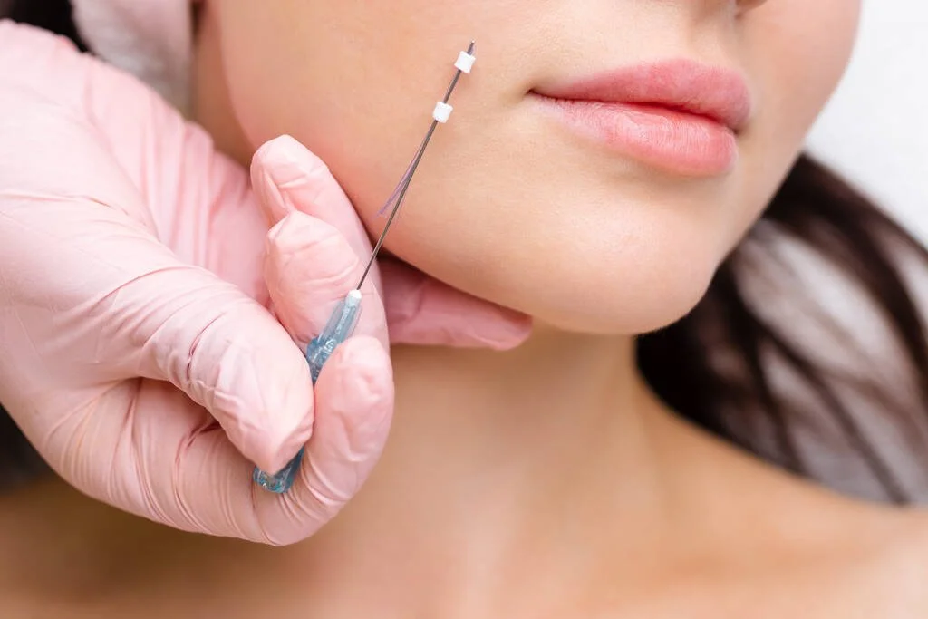 Medspa in St Michael, MN, 55376 PDO Threadlift Near Me