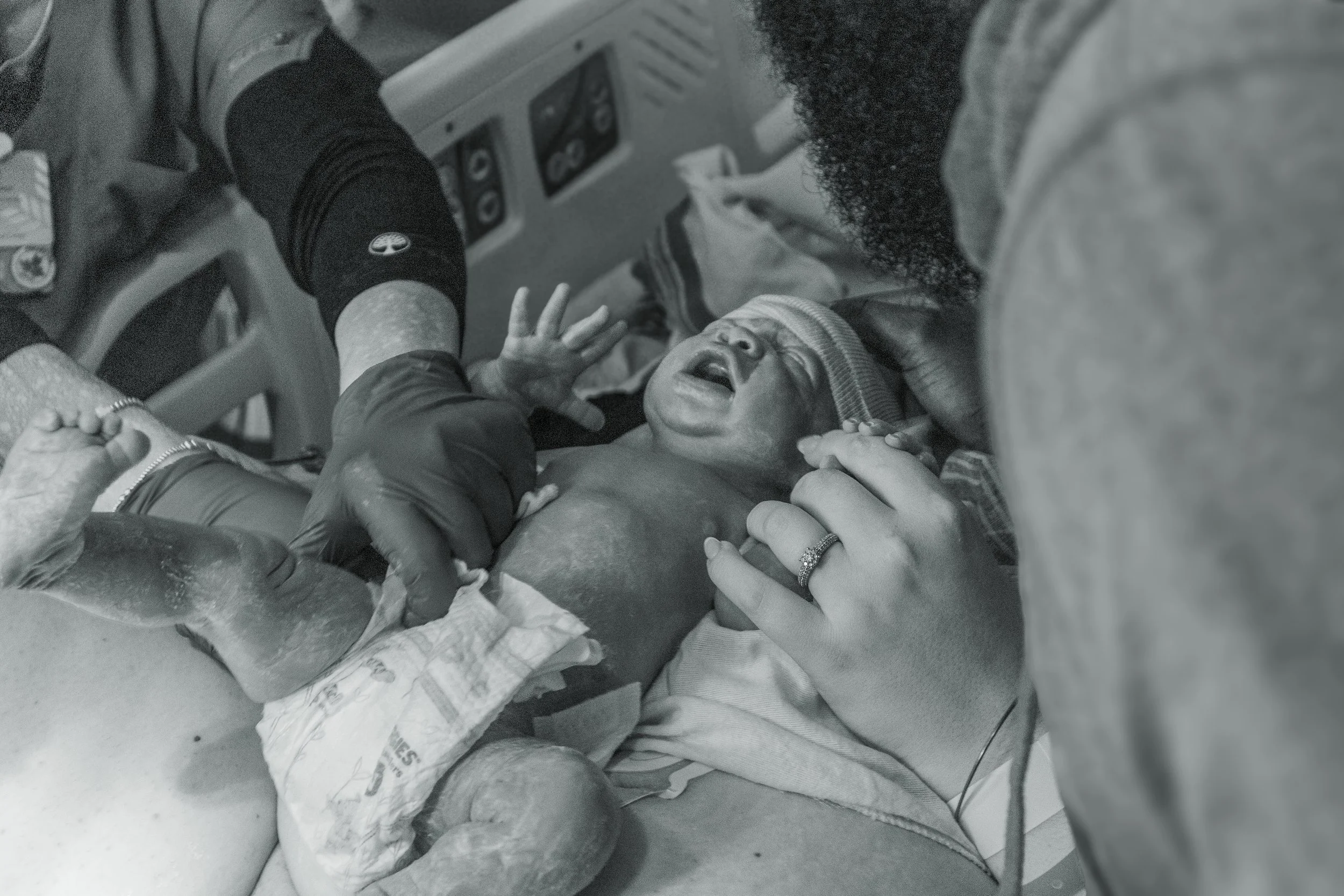 A newborn baby in distress, being held and assisted by medical personnel during childbirth in a hospital setting.