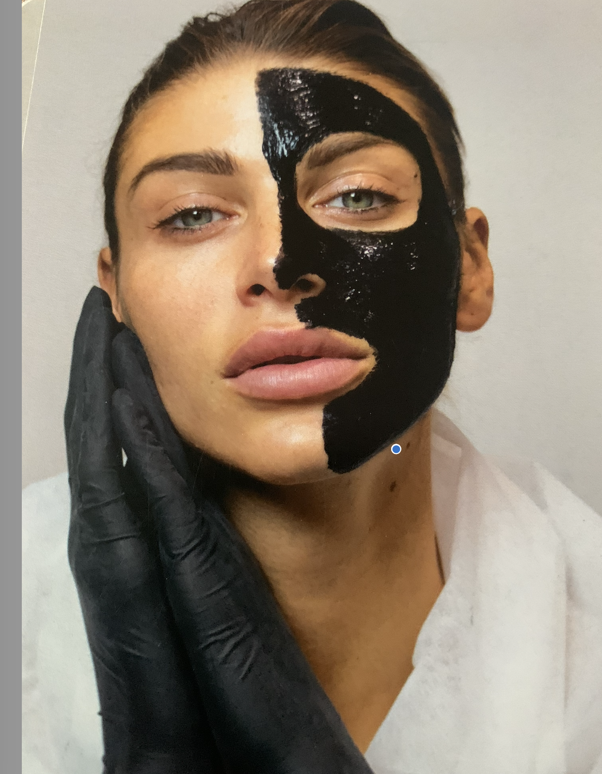 #1 Best Chemical Peel in Vancouver:               V Carbon System for Instant Glow | Imbodi Aesthetics