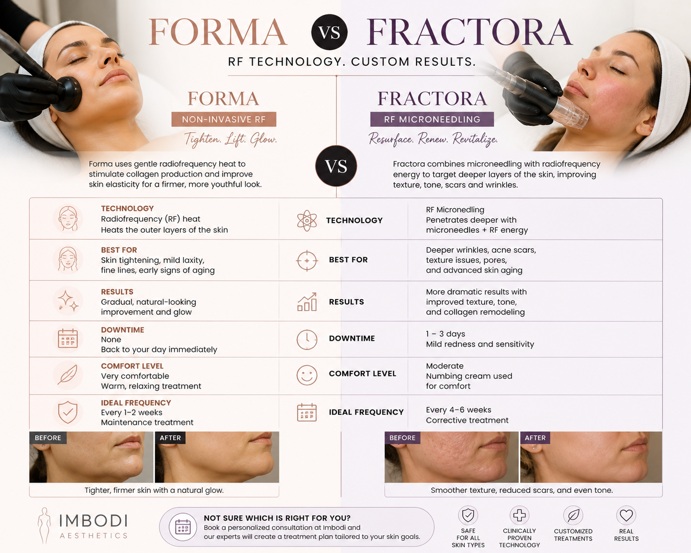 Forma vs Fractora: Which Skin Tightening Treatment Is Better in Vancouver?”