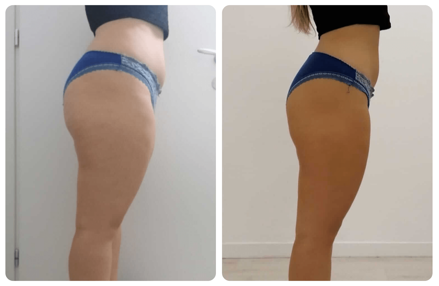 Side-by-side comparison of a woman's lower body before and after fitness, with the left showing less muscle tone and the right showing more toned legs and hips, both in denim shorts and black tops.