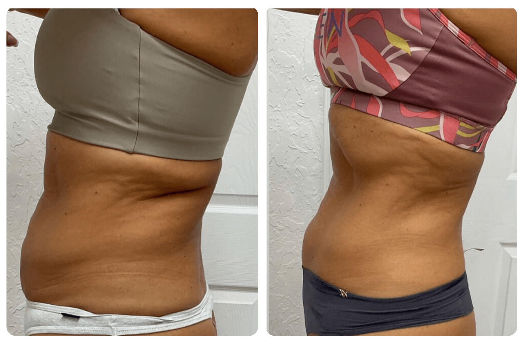 Side-by-side comparison of a woman's torso and waist before and after a body transformation, showing reduction in abdominal fat.