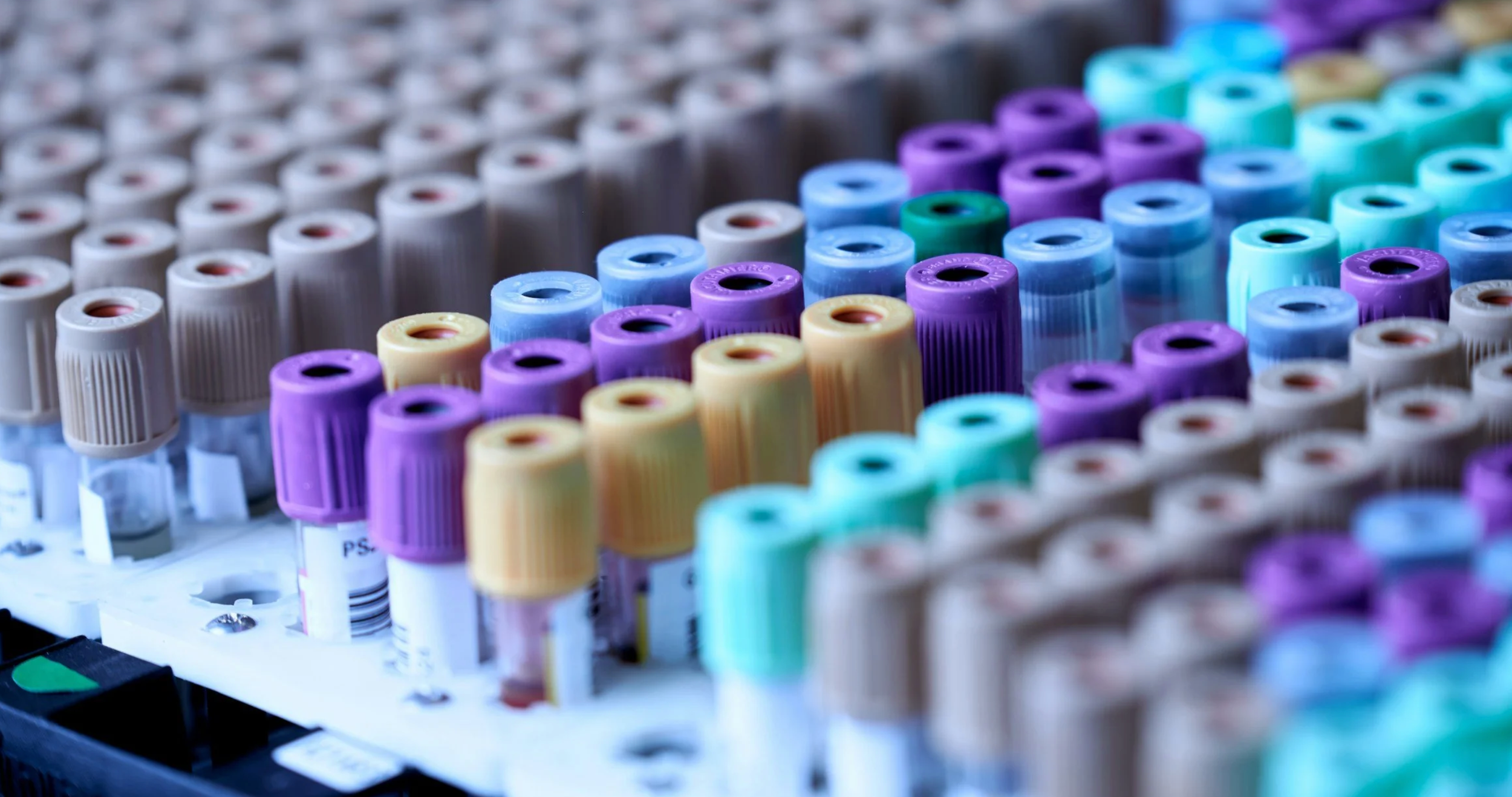 Is your haematocrit too high?